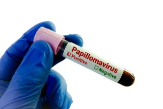 Detección del Virus del Papiloma Humano VPH