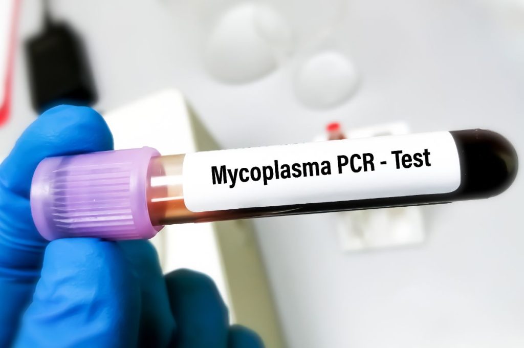 Micoplasmosis en Humanos Sintomas, Tratamiento y Prevencion