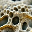 Osteoporosis Diagnóstico Evaluación bioquímica de la osteoporosis