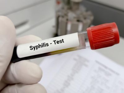 Sifilis - Enfermedad de transmision sexual