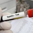 Sífilis Infección Treponema Pallidum