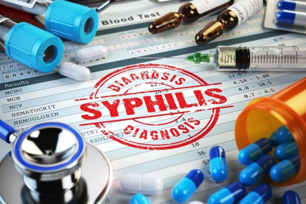 Sífilis, Qué es, Síntomas, Diagnóstico y Tratamiento